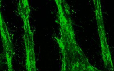 It’s a Stretch: Giving Direction to Blood Vessels