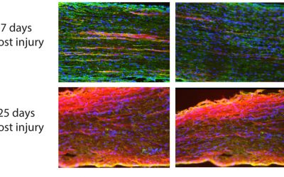 RNA “Specialists” Activate Nerve Regeneration