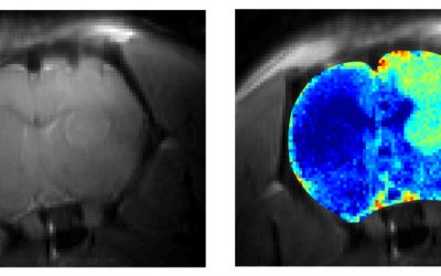 CEST la vie: High-Powered Magnets Improve Early Detection of Cancer in Rats