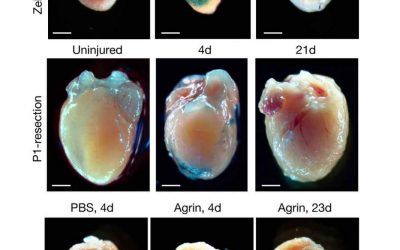 Senescent Cells Bring Life to Injured Hearts