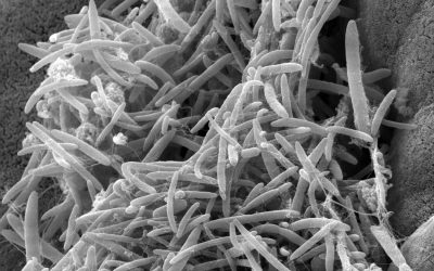 Gut Microbes May Affect the Course of ALS