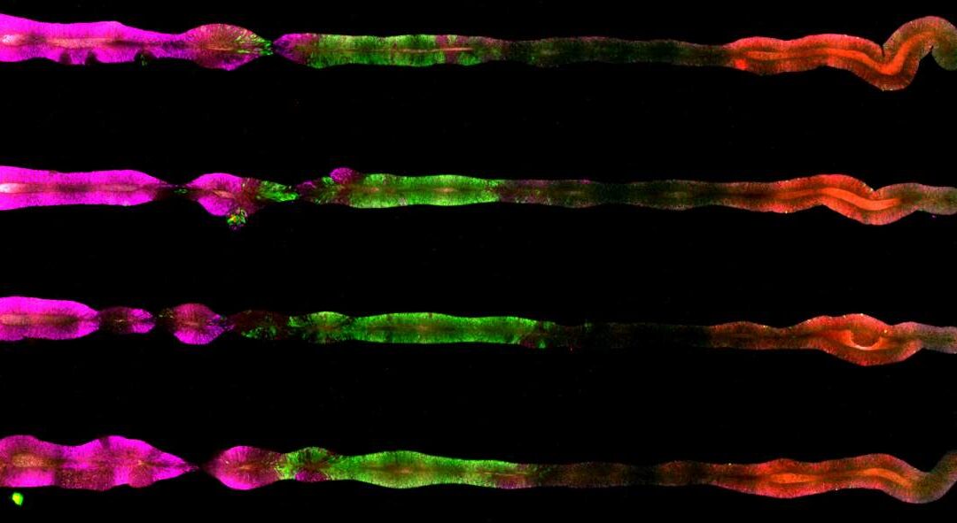 Researchers from the University of Michigan and the Weizmann Institute develop the first-ever complete central nervous system on a chip: It faithfully emulates that of a human embryo, from the forebrain to the bottom of the spinal cord